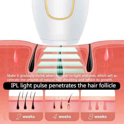 IPL Hair Remover